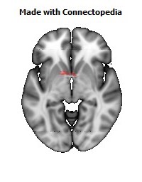 Anterior_Commissure112