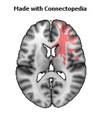 Anterior_corona_radiata_R094