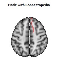 Anterior_limb_of_internal_capsule_R060