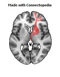 Anterior_limb_of_internal_capsule_R104