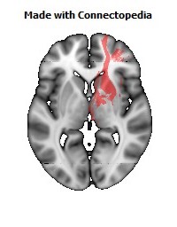 Anterior_limb_of_internal_capsule_R106