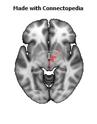 Anterior_limb_of_internal_capsule_R114