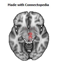 Anterior_limb_of_internal_capsule_R118