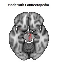 Anterior_limb_of_internal_capsule_R122