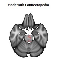 Anterior_limb_of_internal_capsule_R132