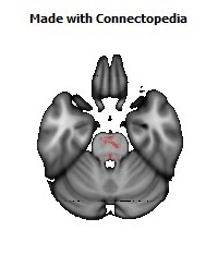 Anterior_limb_of_internal_capsule_R134