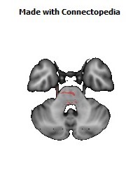 Anterior_limb_of_internal_capsule_R142