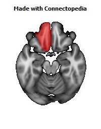 Artery_Anterior_Cerebral_L126