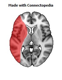 Artery_Middle_Cerebral_L102