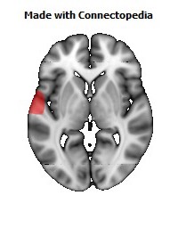 Artery_Middle_Temporal_L106