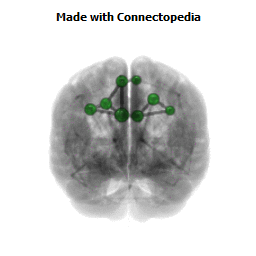 Response proprioceptive stimulation Connectom
