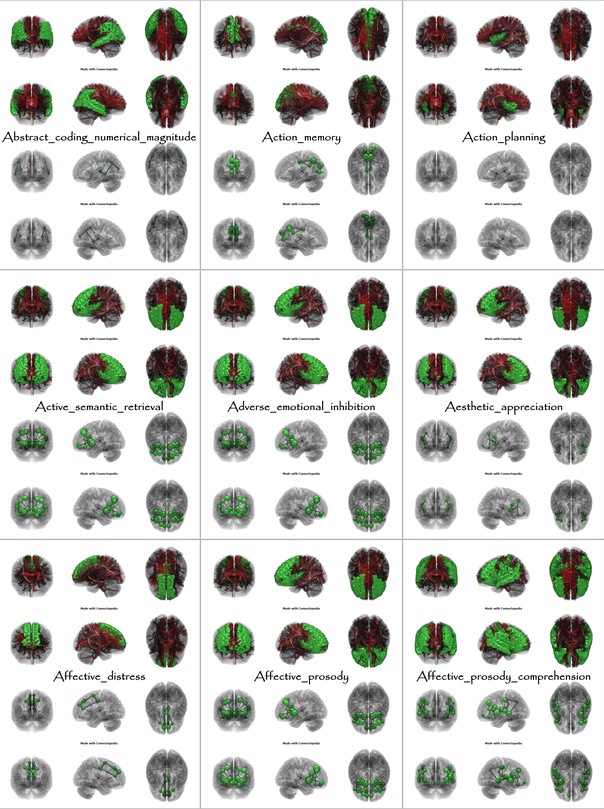 Brain Functions from Abstract_coding_numerical_magnitude to Affective_prosody_comprehension