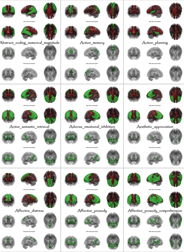 Brain Functions from Abstract_coding_numerical_magnitude to Affective_prosody_comprehension