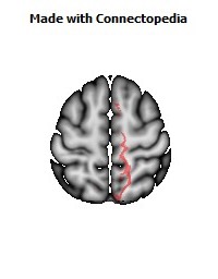 Cerebral_peduncle_R050