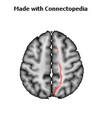 Cerebral_peduncle_R058