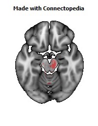 Cerebral_peduncle_R124