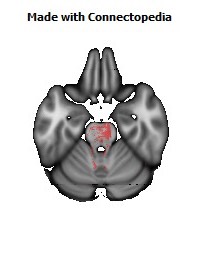 Cerebral_peduncle_R132