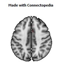 Cingulum_(cingulate_gyrus)_R066