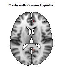 Cingulum_(cingulate_gyrus)_R094