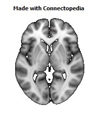 Cingulum_(cingulate_gyrus)_R106