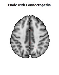 Cingulum_(hippocampus)_R066