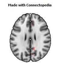 Cingulum_(hippocampus)_R080