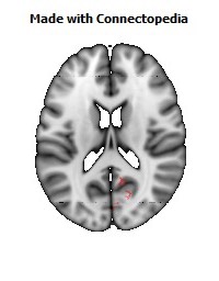 Cingulum_(hippocampus)_R090