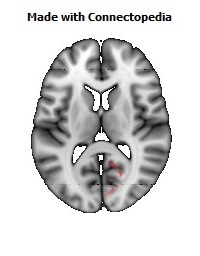 Cingulum_(hippocampus)_R096