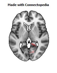 Cingulum_(hippocampus)_R104