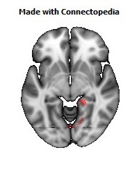 Cingulum_(hippocampus)_R114