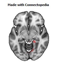 Cingulum_(hippocampus)_R116