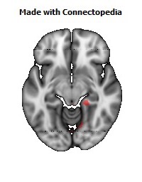 Cingulum_(hippocampus)_R118