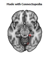 Cingulum_(hippocampus)_R120