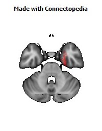 Cingulum_(hippocampus)_R140