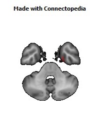 Cingulum_(hippocampus)_R144