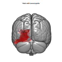 Posterior Cerebral Artery Cortical Extent