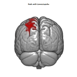 Anterior Cerebral Vein Cortical Extent