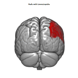 Superficial Middle Cerebral Vein Cortical Extent