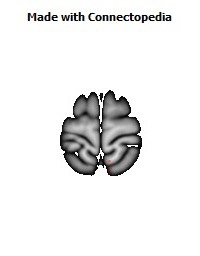 Corticospinal_tract_R038