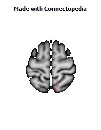 Corticospinal_tract_R044