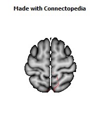 Corticospinal_tract_R046