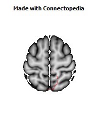 Corticospinal_tract_R048