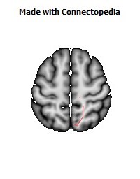 Corticospinal_tract_R052