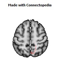 Corticospinal_tract_R054