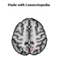 Corticospinal_tract_R056