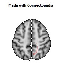 Corticospinal_tract_R058