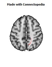 Corticospinal_tract_R060