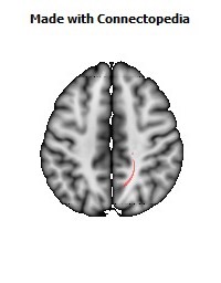 Corticospinal_tract_R062