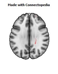 Corticospinal_tract_R078
