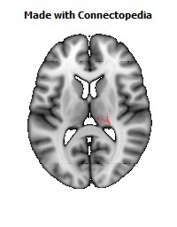 Corticospinal_tract_R096